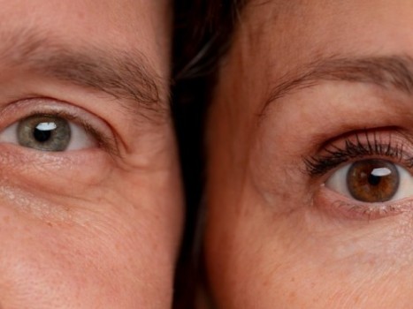 Spušteni očni kapci – razlog za brigu?